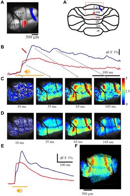 Large Scale Calcium Imaging of the Cerebellar Vermis During Sensory Stimulus Unravels Two Response’s Components That Differ in Their Spatiotemporal Properties